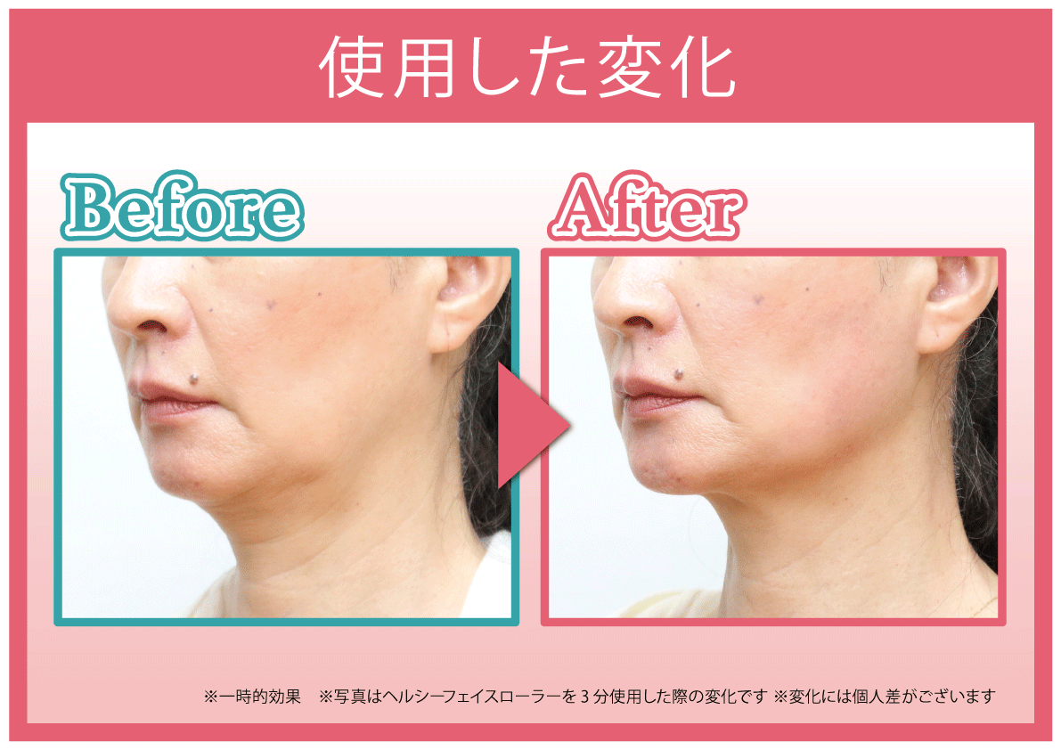 ヘルシーフェイスローラー